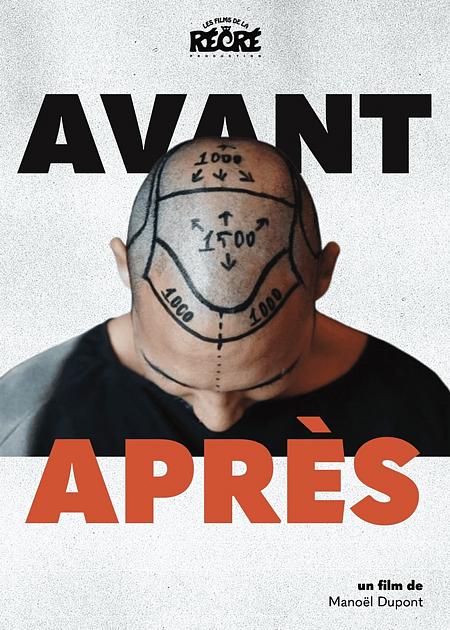 AVANT / APRES (BEFORE / AFTER)
